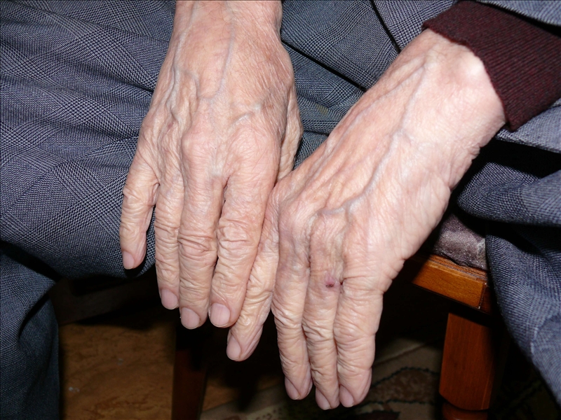 Elderly_Hands.jpg