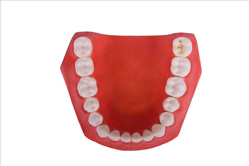 False_Teeth.jpg