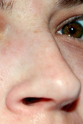 Nose.jpg